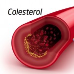 Diferencias entre el colesterol bueno y el malo Multitematica
