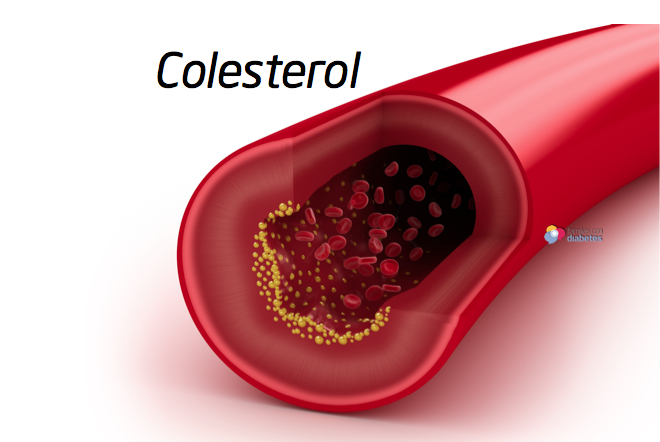 colesterol