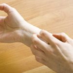 Cómo curar picaduras de chinches Salud