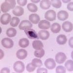 Parásitos que manipulan a otro organismo Ciencia y Medio Ambiente