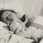 ¿Cuáles son los síntomas de conversión? Salud