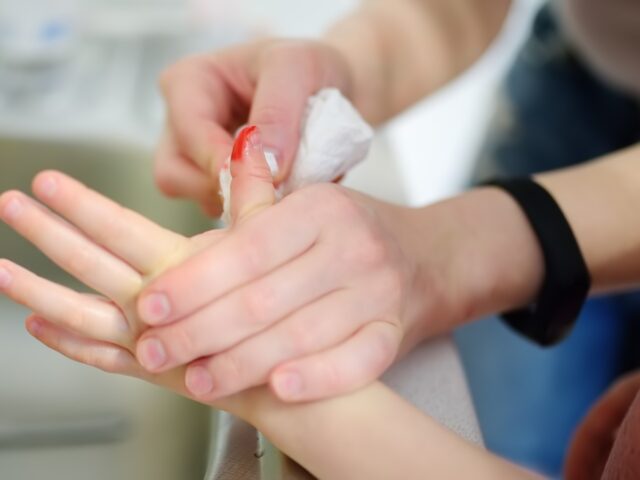 Pequeños accidentes caseros, ¿qué hacer? Accidente casero